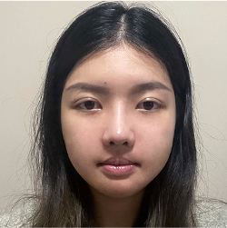 术后第3周