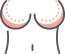胸部整形
