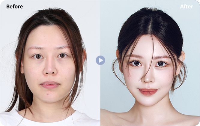 Case review 4: supplied before and after photographs side by side.