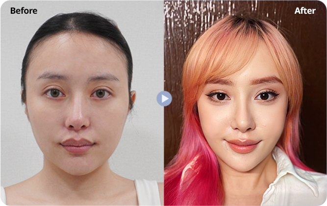 Case review 2: supplied before and after photographs side by side.