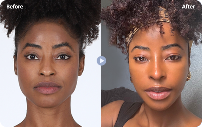 Case review 5: supplied before and after photographs side by side.