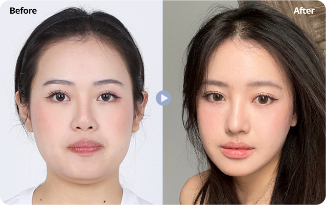 Case review 1: supplied before and after photographs side by side.