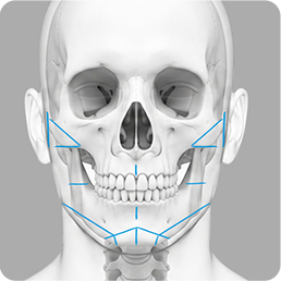 Front-view facial skeleton with planning lines for cheekbone, jawline, and chin contouring.