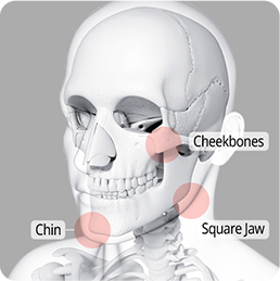 Facial skeleton identifying the cheekbones, square jaw, and chin as bone contouring areas.