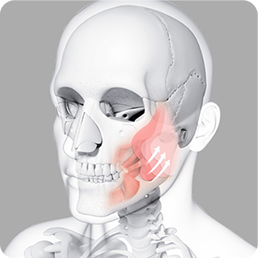 Illustration of facial soft tissue repositioning with upward arrows along the cheek and jawline.