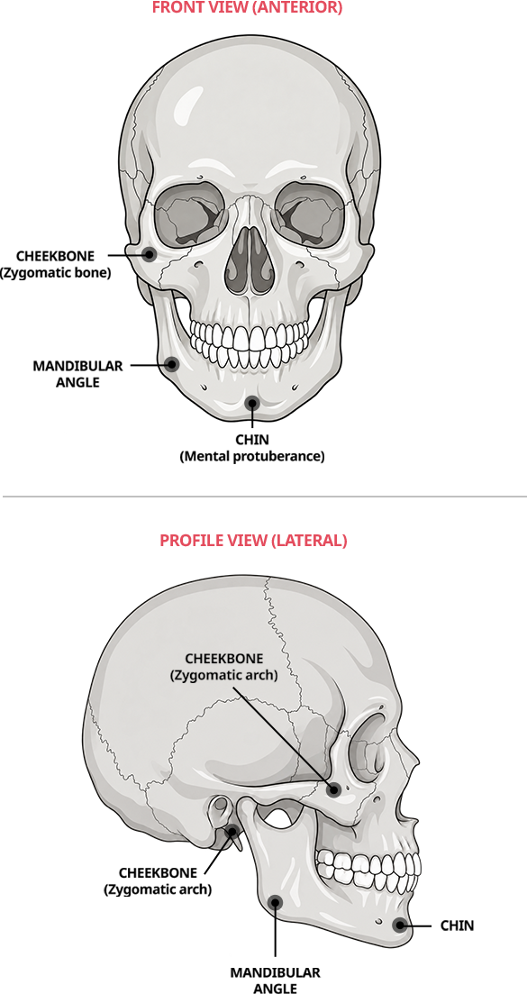 Front and profile skull diagrams identifying the cheekbones, mandibular angle, and chin