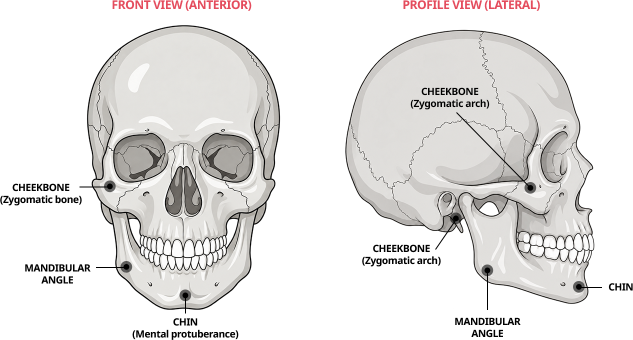Front and profile skull diagrams identifying the cheekbones, mandibular angle, and chin