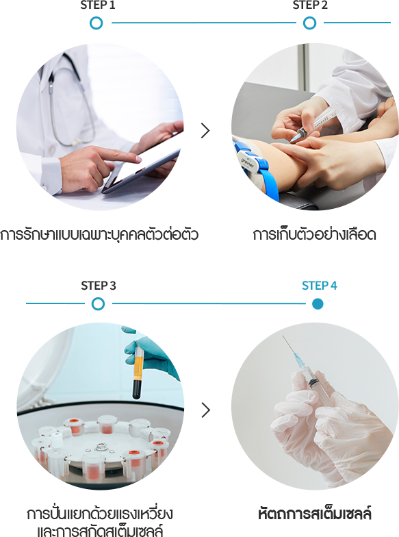 줄기세포 시술방법
